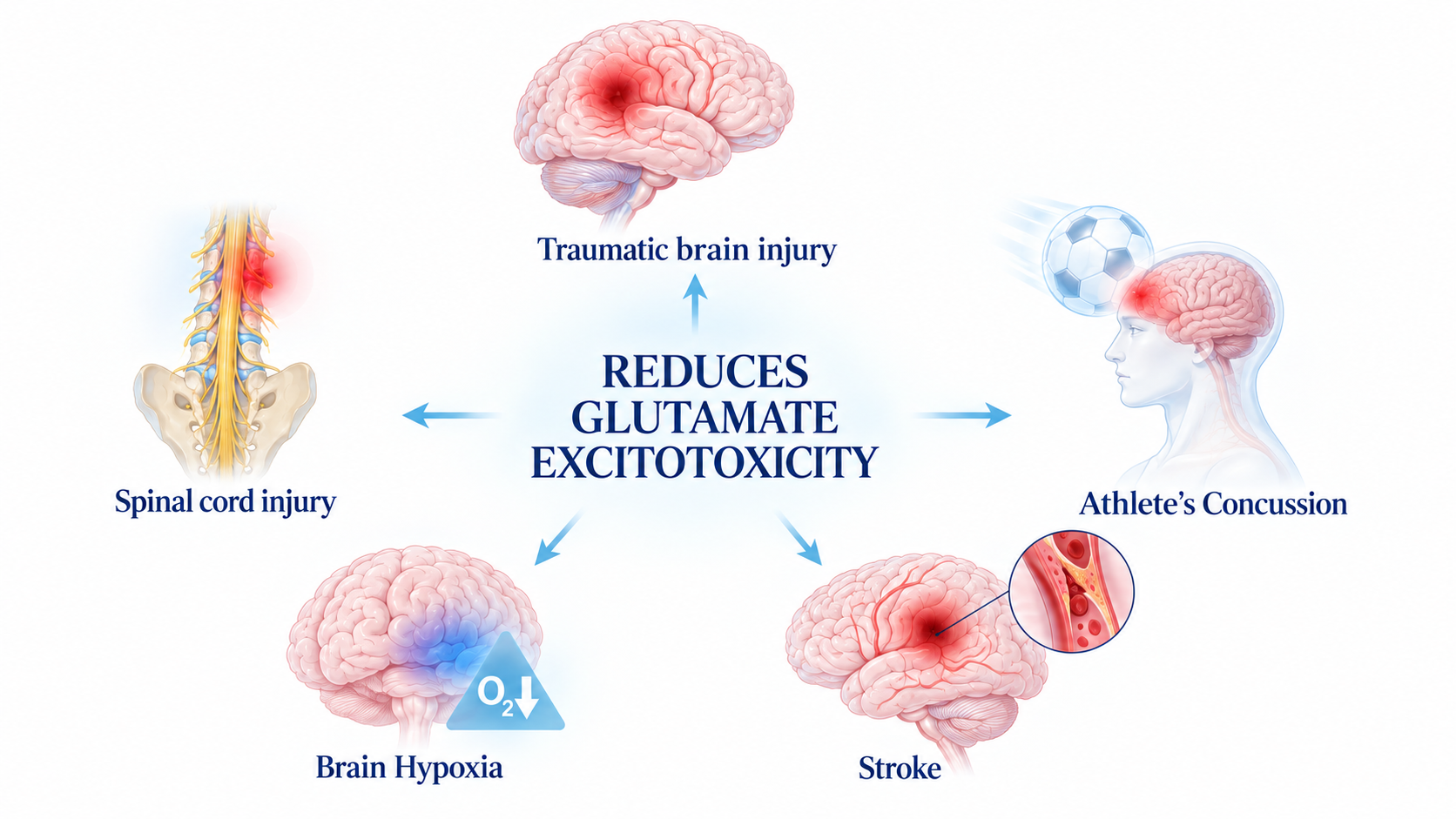 NeuroHagana platform: reducing glutamate excitotoxicity across spinal cord injury, traumatic brain injury, stroke, athlete's concussion and brain hypoxia